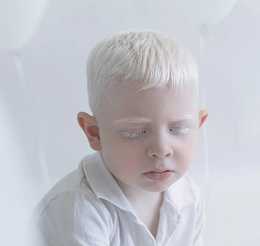 Фенилкетонурия