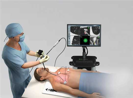 Бронхоскопия