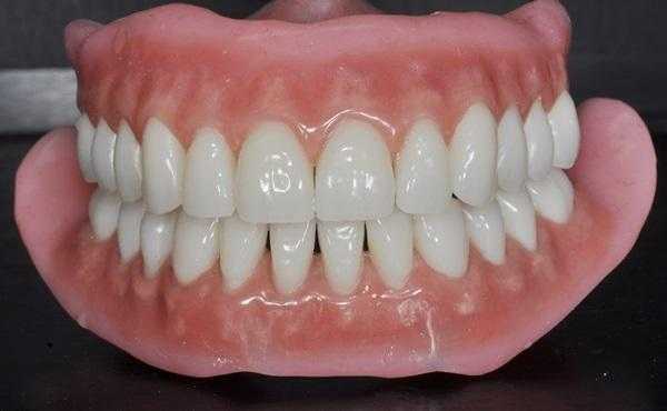 Биомеханика и окклюзия при полном протезировании