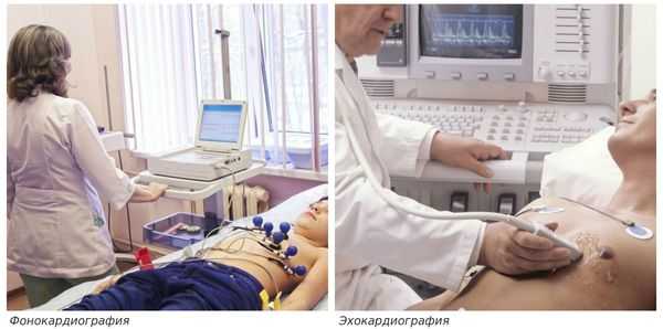 ФКГ и Эхо-КГ