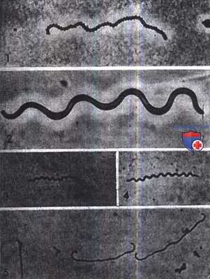 Различные виды спирохет