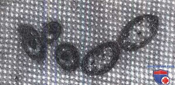 формы риккетсий