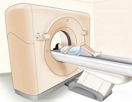 Компьютерная томография