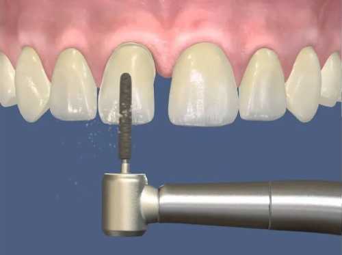 obtochka pod shtampovannuyu koronku