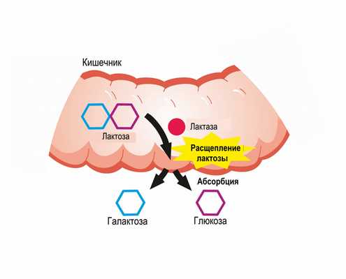 Галактоземия