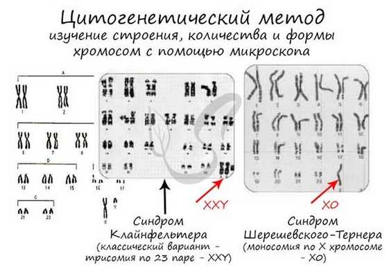 Цитогенетический метод исследования
