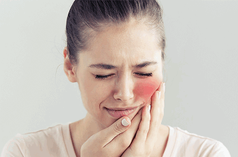 Ганглионеврит