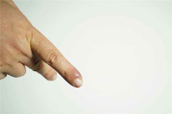 Инфекционное поражение.jpg