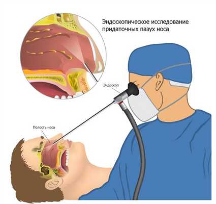 shutterstock_576679978 [- эндоскопия.jpg