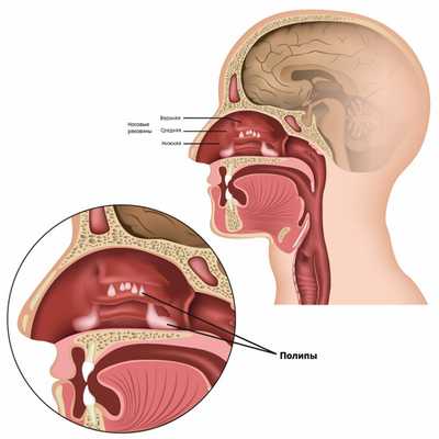 shutterstock_1318362653 - полипы.jpg