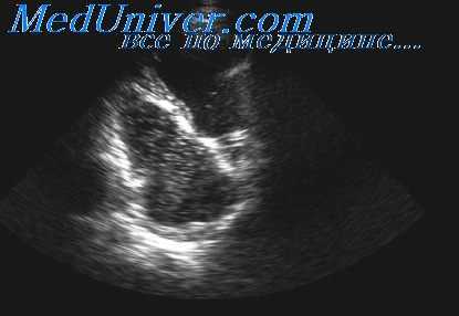 прекардиальные наблюдения