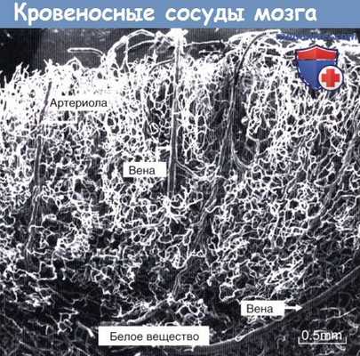 Кровеносные сосуды мозга