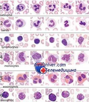 морфология клеток крови