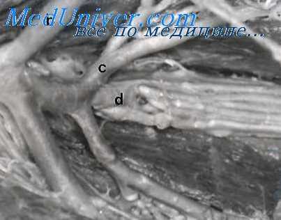 артериальная гиперемия