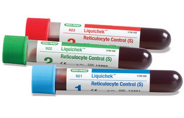 Общий анализ крови - метод обнаружения ретикулоцитоза