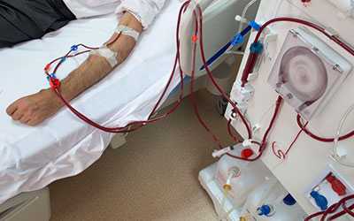 Гемосорбция - Угодие