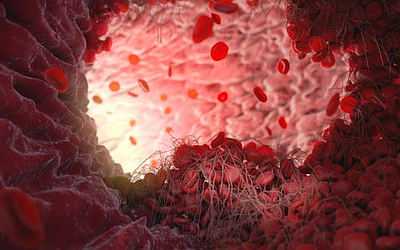 Изображение 4 - Лечение плазмаферезом - клиника Угодие