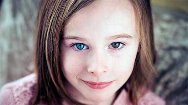 Гетерохромия