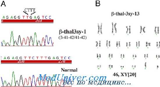 генетика сложных талассемий