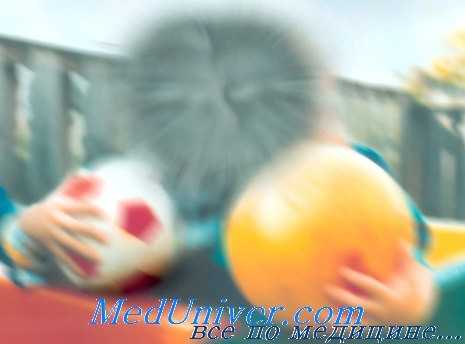 возрастная дегенерация макулы