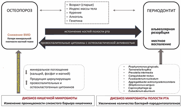 Двунаправленная взаимосвязь между остеопорозом (ОП) и пародонтитом (ПД). У них есть ряд общих факторов риска