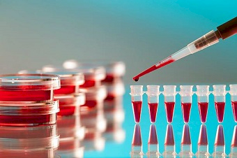 Анализ крови