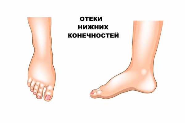 Отек.jpg