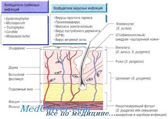 причины инфекций кожи