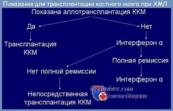 Трансплантация костного мозга при хроническом миелолейкозе
