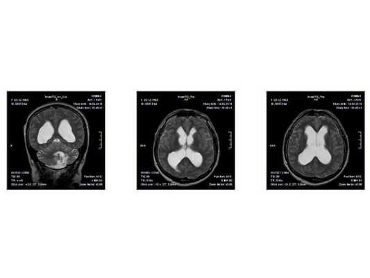 МРТ от 14.05.2013