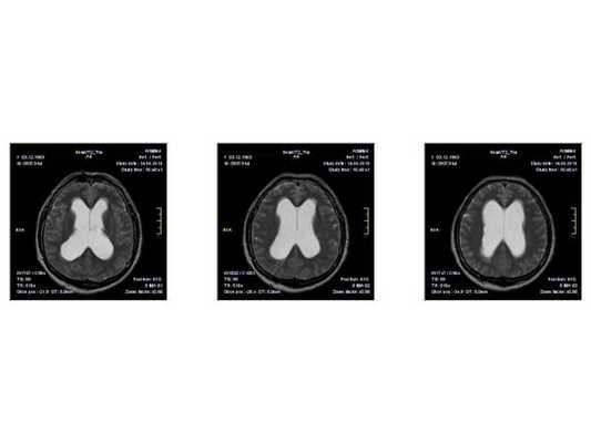 МРТ от 14.05.2013