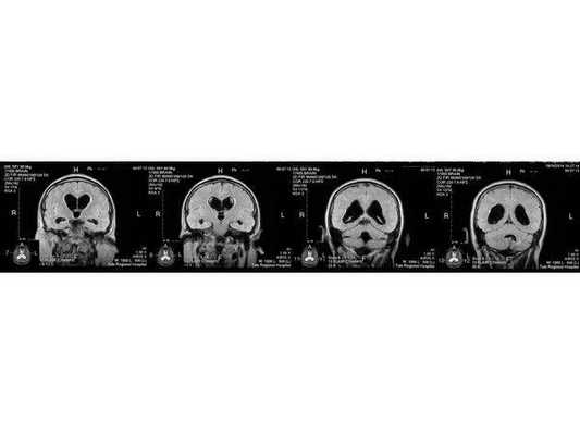 МРТ от 16.10.2014