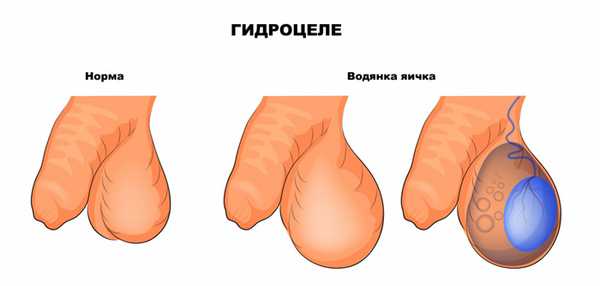 Норма и болезнь.jpg