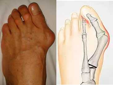 внешний-вид-стопы