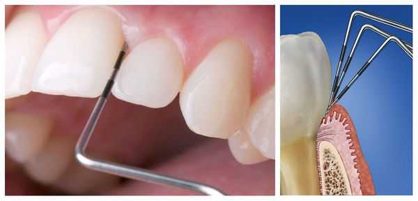 Тактильный тест (зондирование)