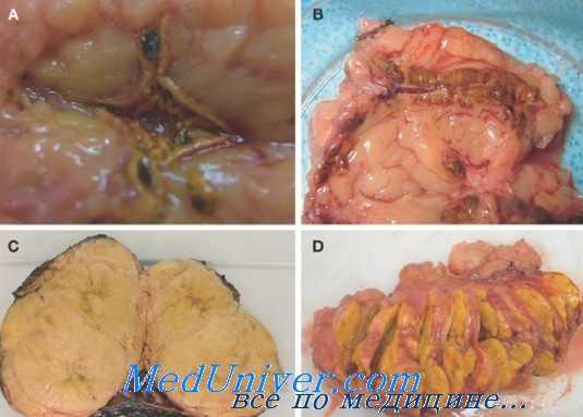 болезнь конна
