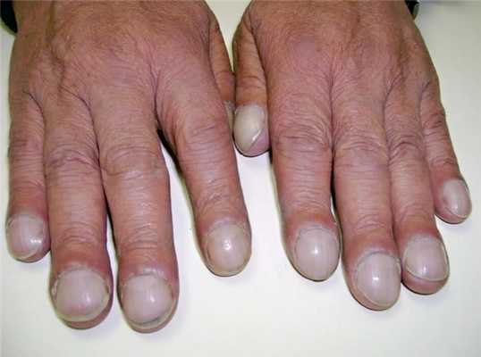 пальцы барабанные палочки