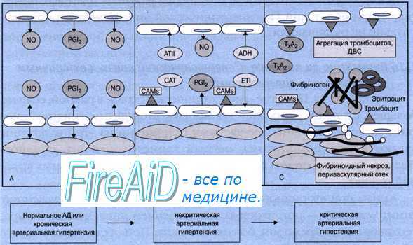 Гипертонический криз. Причины ( этиология ) гипертонического криза. Патогенез, классификация гипертонического криза.