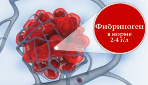 Гипофибриногенемия