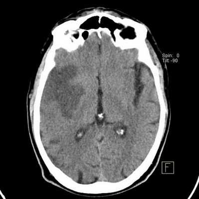 Пахтусова Наталья Александровна, вертебролог, детский невролог, невролог - Пермь