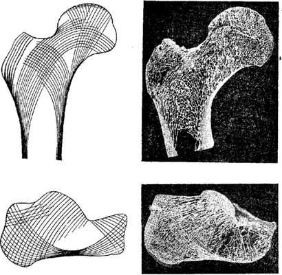 Правый верхний рисунок — фронтальный распил верхнего отдела бедренной кости; хорошо видны расположения костных перекладин