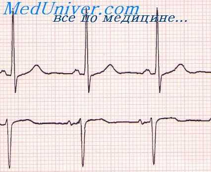 гистография сердца