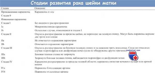 Стадии развития рака шейки матки