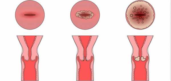 патология шецки матки.jpg