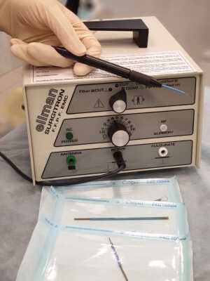 Аппарат Сургитрон для биопсии шейки матки