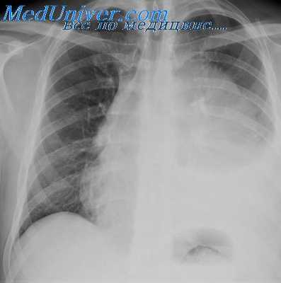 образование средостения