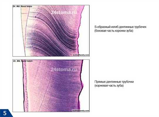 Форма дентинных канальцев в коронковой и корневой частях зуба