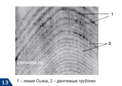 Контурные линии Оуэна