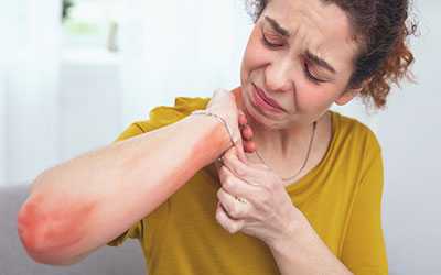 Кожный зуд - Веримед