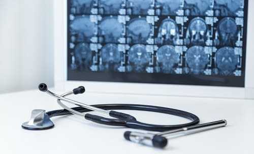 Диагностика и план лечения головокружения